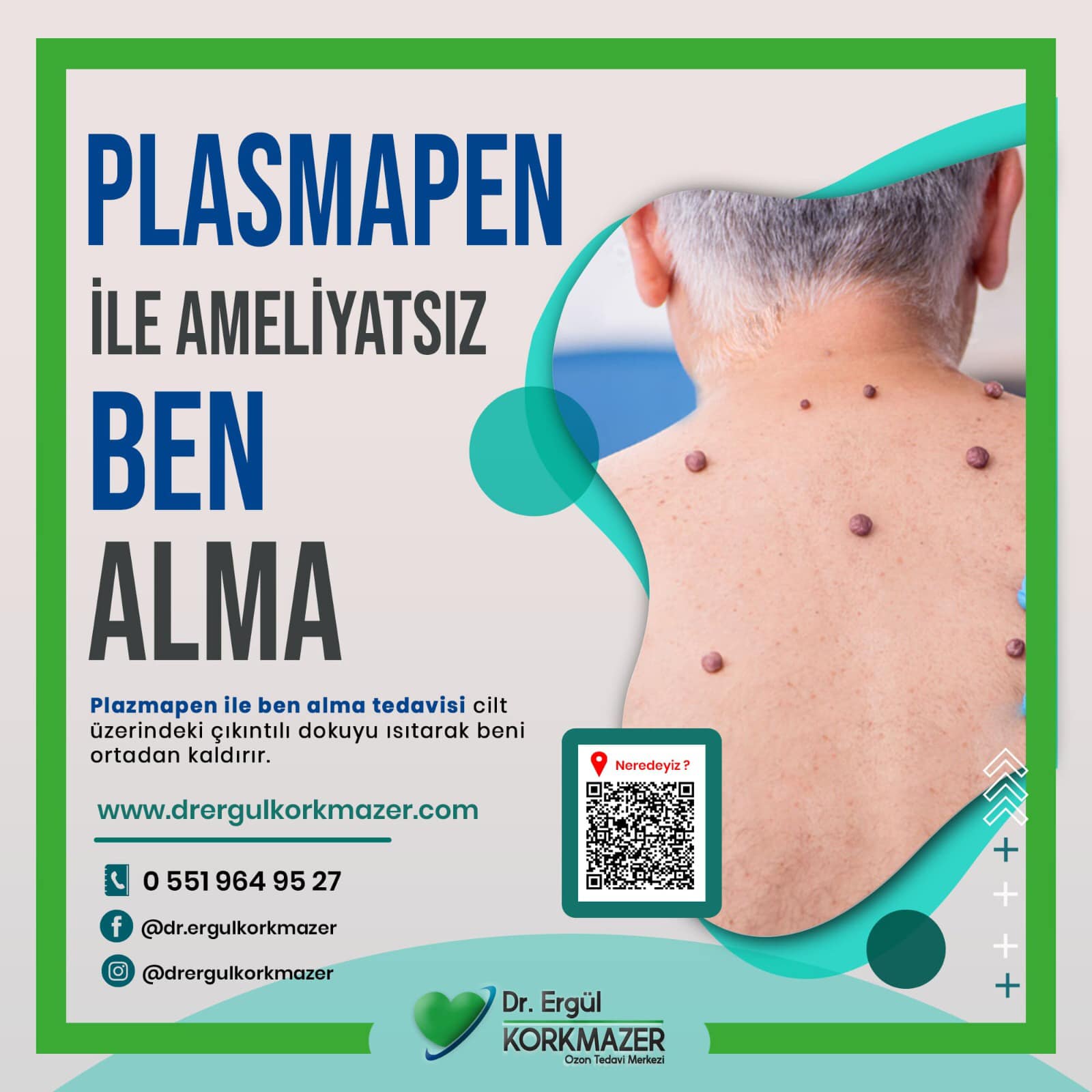 PLASMAPEN AMELİYATSIZ BEN ALMA